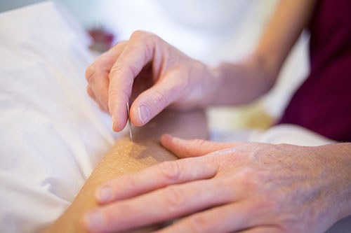 Advertise your Kelowna area Acupuncture services to your service area patients.
